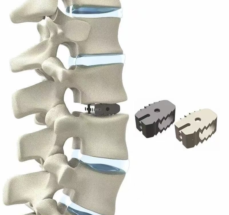 PEEK Material - Empowering the Medical Industry